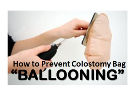 stoma bag ballooning